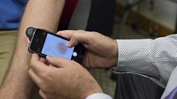 App kan hjälpa läkare bedöma hudcancer